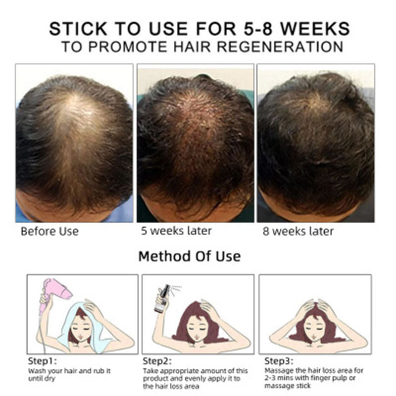 Hair Growth & Scalp Treatment Oil