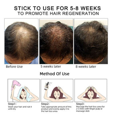 Hair Growth & Scalp Treatment Oil