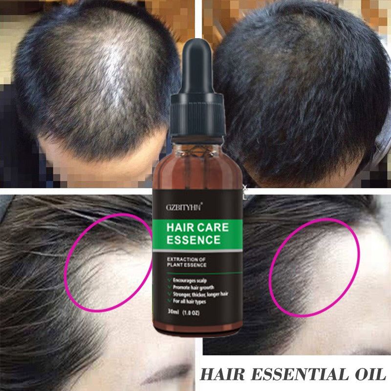 Hair Growth & Scalp Treatment Oil