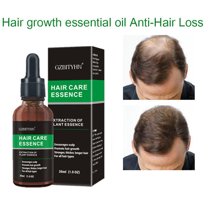 Hair Growth & Scalp Treatment Oil