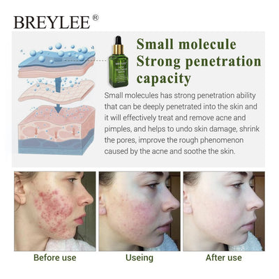 Clear Skin by BREYLEE