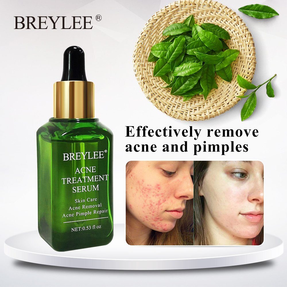 Clear Skin by BREYLEE