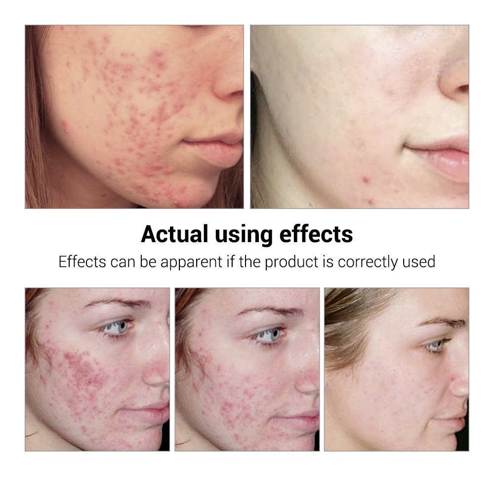 Clear Skin by BREYLEE
