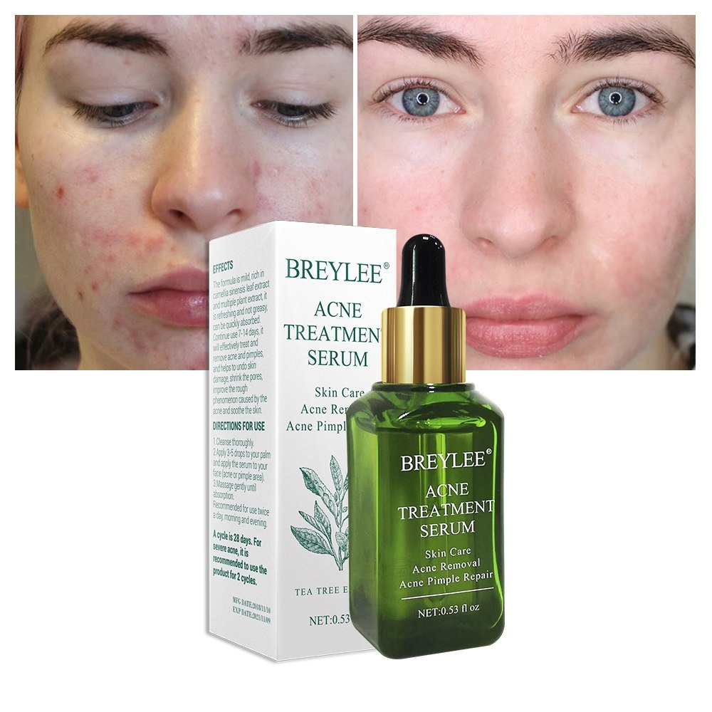 Clear Skin by BREYLEE