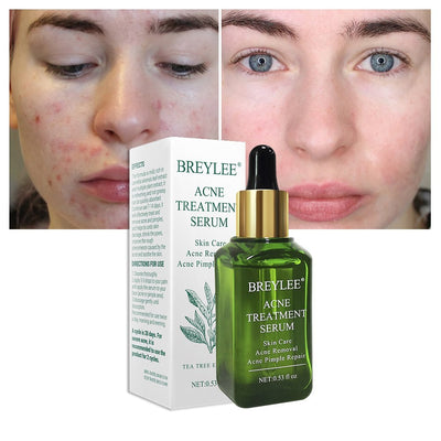 Clear Skin by BREYLEE